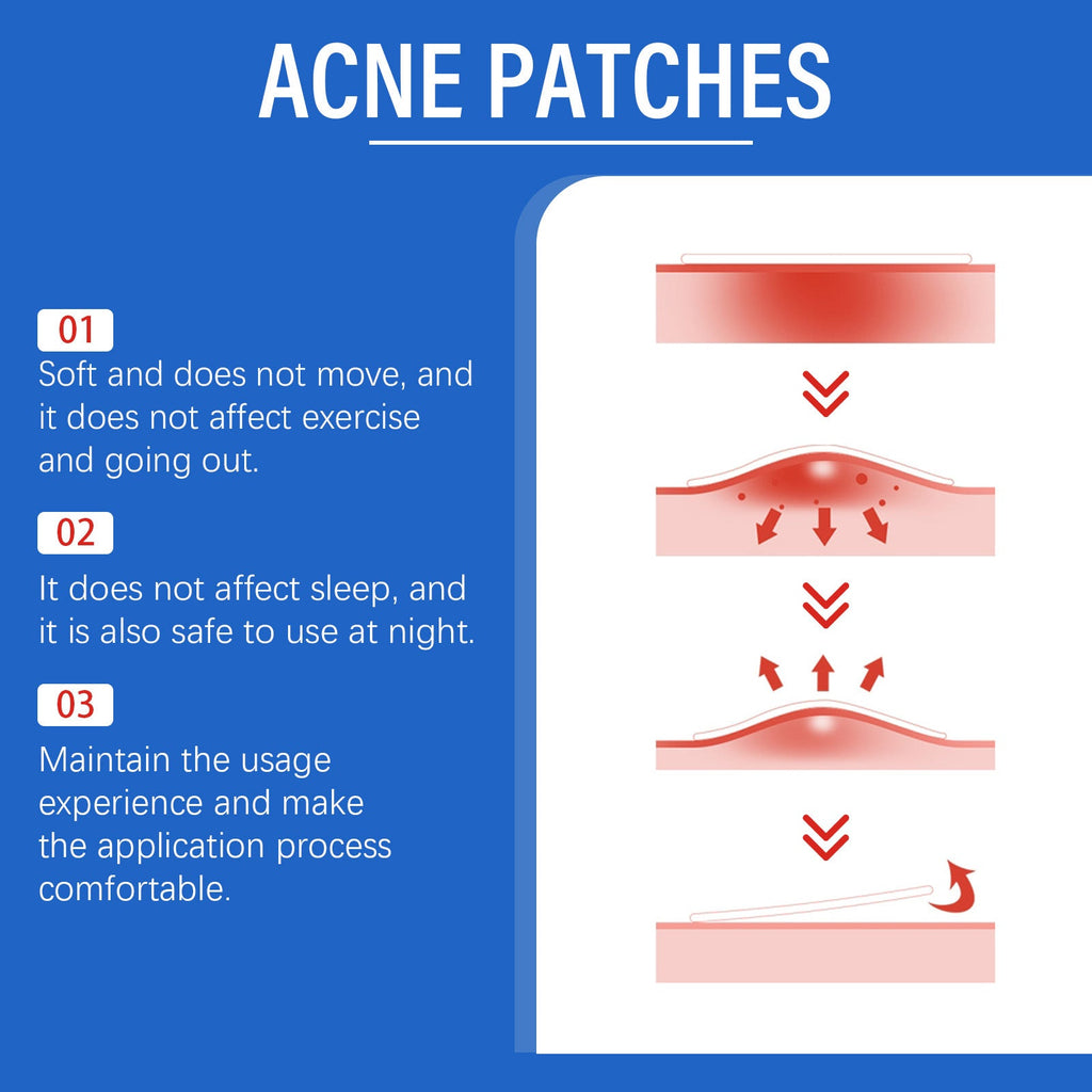 Acne Patch Gentle Facial Care THRU7